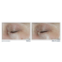 MULTI CORREXION® Hydrate & Plump Eye Cream