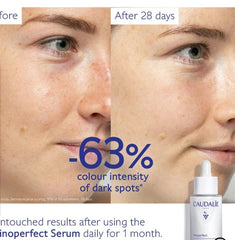 Caudalíe Vinoperfect Dark Spot Brightening Serum Vitamin C Alternative - 30ml