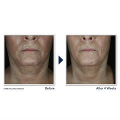 DERM CORREXION® Contour Cream